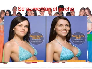 Se aumentan el pecho
 