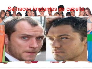 Se hacen implantes de cabello
 