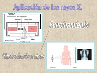 http://es.over-blog.com/Como_funciona_un_tubo_de_rayos_x-1228321783-art164329.html
 