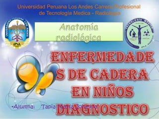 Universidad Peruana Los Andes Carrera Profesional
de Tecnología Medica - Radiología
•Alumna: Tapia Mayta Johanna
 