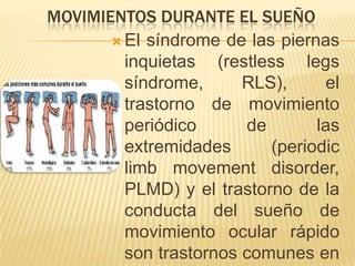MOVIMIENTOS DURANTE EL SUEÑO
 El síndrome de las piernas
inquietas (restless legs
síndrome,
RLS),
el
trastorno de movimiento
periódico
de
las
extremidades
(periodic
limb movement disorder,
PLMD) y el trastorno de la
conducta del sueño de
movimiento ocular rápido
son trastornos comunes en

 