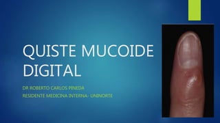 QUISTE MUCOIDE
DIGITAL
DR ROBERTO CARLOS PINEDA
RESIDENTE MEDICINA INTERNA- UNINORTE
 