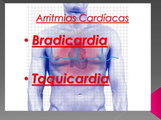 Arritmias Cardíacas
• Bradicardia
• Taquicardia
 