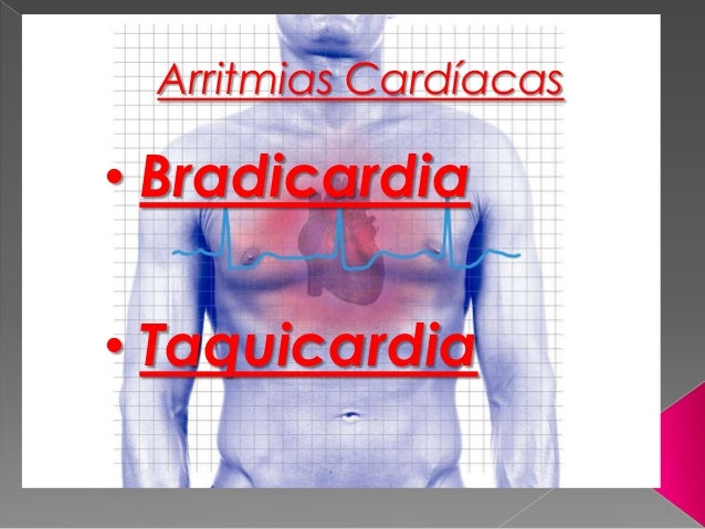 Arritmias Bradicardia E Taquicardia Arritmias Bradicardia E Taquicardia
