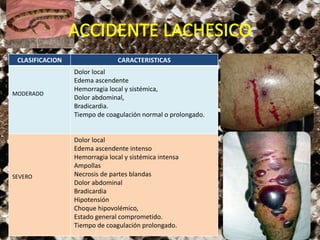 CLASIFICACION CARACTERISTICAS
MODERADO
Dolor local
Edema ascendente
Hemorragia local y sistémica,
Dolor abdominal,
Bradicardia.
Tiempo de coagulación normal o prolongado.
SEVERO
Dolor local
Edema ascendente intenso
Hemorragia local y sistémica intensa
Ampollas
Necrosis de partes blandas
Dolor abdominal
Bradicardia
Hipotensión
Choque hipovolémico,
Estado general comprometido.
Tiempo de coagulación prolongado.
 