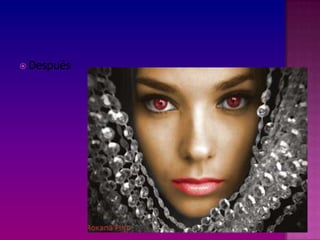 Después
 