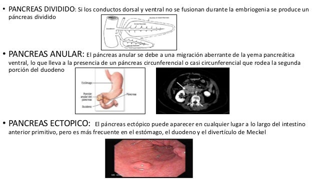 Pancreas Generalidades Pancreas Generalidades