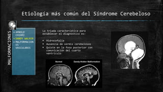 MALFORMACIONES
• ARNOLD
CHIARI
• DANDY WALKER
• MALFORMACION
ES
VASCULARES
Etiología más común del Síndrome Cerebeloso
La triada característica para
establecer el diagnostico es:
 Hidrocefalia
 Ausencia de vermis cerebelosos
 Quiste en la fosa posterior con
comunicación del cuarto
ventrículo
 