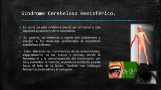 Síndrome Cerebeloso Hemisférico.
▪ La causa de este síndrome puede ser un tumor o una
isquemia en un hemisferio cerebeloso.
▪ En general, los síntomas y signos son unilaterales y
afectan a los músculos ipsilaterales al hemisferio
cerebeloso enfermo.
▪ Están alterados los movimientos de las extremidades,
especialmente de los brazos y piernas, donde la
hipermetría y la descomposición del movimiento son
muy evidentes. A menudo, se produce oscilación y caída
hacia el lado de la lesión. También son hallazgos
frecuentes la disartria y el nistagmo.
 