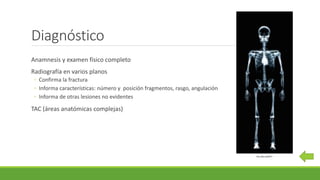 Diagnóstico
Anamnesis y examen físico completo
Radiografía en varios planos
◦ Confirma la fractura
◦ Informa características: número y posición fragmentos, rasgo, angulación
◦ Informa de otras lesiones no evidentes
TAC (áreas anatómicas complejas)
http://goo.gl/pBfJ7J
 