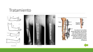 Tratamiento
http://goo.gl/DqXGLI http://goo.gl/CQKKS1
 