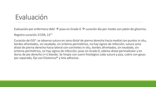 Evaluación
Evaluación por enfermera IAAS  púas en Grado 0  curación día por medio con jabón de glicerina.
Registro curación 27/04, 13°°
Curación de EID°: se observa sutura en zona distal de pierna derecha hacia medial con puntos in situ,
bordes afrontados, sin exudado, sin eritema perimétrico, no hay signos de infección; sutura zona
distal de pierna derecha hacia lateral con corchetes in situ, bordes afrontados, sin exudado, sin
eritema perimétrico, no hay signos de infección; púas en Grado 0, edema distal perimaleolar y en
dorso de pie derecho (++) blando. Se limpia con suero fisiológico cada sutura y púa, cubro con gasas
por separado, fijo con Elastomul® y tela adhesiva.
 