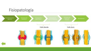 Fisiopatología
Callo blando Callo duro
Traumatismo de un
segmento
Formación de
hematoma
Formación de
tejido fibroso
Formación de
tejido cartilaginoso
Formación de
tejido óseo
inmaduro
Remodelación
 