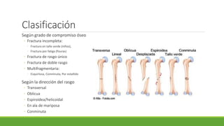 Clasificación
Según grado de compromiso óseo
◦ Fractura incompleta:
◦ Fractura en tallo verde (niños),
◦ Fractura por fatiga (fisuras)
◦ Fractura de rasgo único
◦ Fractura de doble rasgo
◦ Multifragmentaria:
◦ Esquirlosa, Conminuta, Por estallido
Según la dirección del rasgo
◦ Transversal
◦ Oblicua
◦ Espiroidea/helicoidal
◦ En ala de mariposa
◦ Conminuta
 