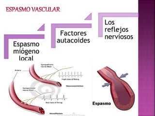 Espasmo
miógeno
local
Factores
autacoides
Los
reflejos
nerviosos
 