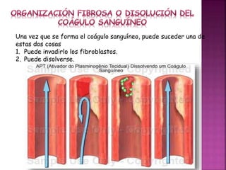 Una vez que se forma el coágulo sanguíneo, puede suceder una de
estas dos cosas
1. Puede invadirlo los fibroblastos.
2. Puede disolverse.
 