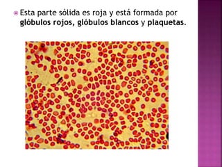  Esta parte sólida es roja y está formada por
glóbulos rojos, glóbulos blancos y plaquetas.
 