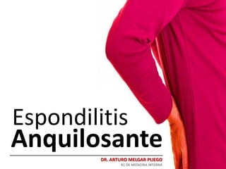 DR. ARTURO MELGAR PLIEGO
R1 DE MEDICINA INTERNA
Espondilitis
Anquilosante
 