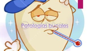 PATOLOGIAS BUCALES