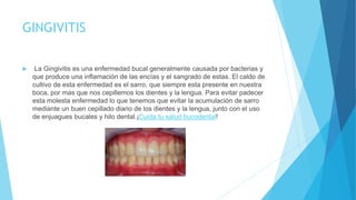 GINGIVITIS
 La Gingivitis es una enfermedad bucal generalmente causada por bacterias y
que produce una inflamación de las encías y el sangrado de estas. El caldo de
cultivo de esta enfermedad es el sarro, que siempre esta presente en nuestra
boca, por mas que nos cepillemos los dientes y la lengua. Para evitar padecer
esta molesta enfermedad lo que tenemos que evitar la acumulación de sarro
mediante un buen cepillado diario de los dientes y la lengua, junto con el uso
de enjuagues bucales y hilo dental.¡Cuida tu salud bucodental!
 