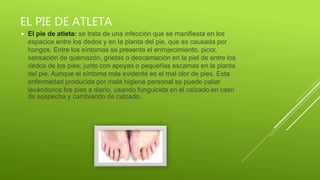 EL PIE DE ATLETA
El pie de atleta: se trata de una infección que se manifiesta en los
espacios entre los dedos y en la planta del pie, que es causada por
hongos. Entre los síntomas se presenta el enrojecimiento, picor,
sensación de quemazón, grietas o descamación en la piel de entre los
dedos de los pies; junto con apoyas o pequeñas escamas en la planta
del pie. Aunque el síntoma más evidente es el mal olor de pies. Esta
enfermedad producida por mala higiene personal se puede paliar
lavándonos los pies a diario, usando funguicida en el calzado en caso
de sospecha y cambiando de calzado.