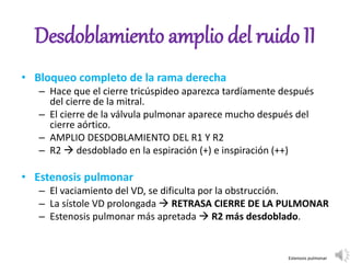 Desdoblamiento amplio del ruido II
• Bloqueo completo de la rama derecha
– Hace que el cierre tricúspideo aparezca tardíamente después
del cierre de la mitral.
– El cierre de la válvula pulmonar aparece mucho después del
cierre aórtico.
– AMPLIO DESDOBLAMIENTO DEL R1 Y R2
– R2  desdoblado en la espiración (+) e inspiración (++)
• Estenosis pulmonar
– El vaciamiento del VD, se dificulta por la obstrucción.
– La sístole VD prolongada  RETRASA CIERRE DE LA PULMONAR
– Estenosis pulmonar más apretada  R2 más desdoblado.
Estenosis pulmonar
 