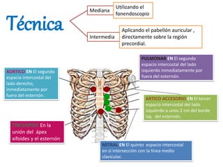 Técnica
Mediana
Intermedia
Utilizando el
fonendoscopio
Aplicando el pabellón auricular ,
directamente sobre la región
precordial.
TRICUSPIDE En la
unión del ápex
xifoides y el esternón
AORTICO EN El segundo
espacio intercostal del
lado derecho,
inmediatamente por
fuera del esternón.
PULMONAR EN El segundo
espacio intercostal del lado
izquierdo inmediatamente por
fuera del esternón.
MITRAL EN El quinto espacio intercostal
en si intersección con la línea medio
clavicular.
ARTICO ACCESORIO EN El tercer
espacio intercostal del lado
izquierdo a unos 2 cm del borde
izq. del esternón.
 