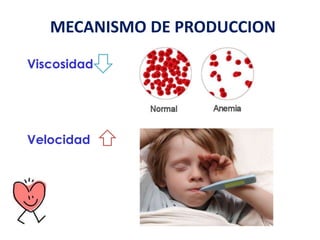 MECANISMO DE PRODUCCION
Viscosidad
Velocidad
 