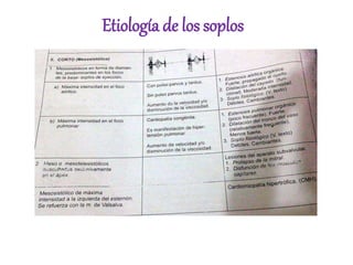 Etiología de los soplos
 