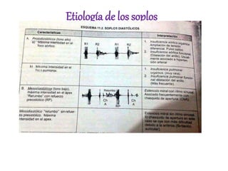 Etiología de los soplos
 