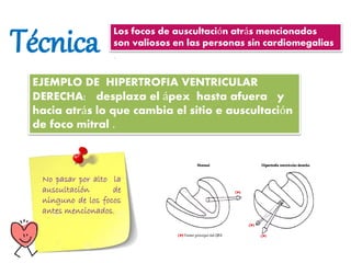 Técnica Los focos de auscultación atrás mencionados
son valiosos en las personas sin cardiomegalias
.
EJEMPLO DE HIPERTROFIA VENTRICULAR
DERECHA: desplaza el ápex hasta afuera y
hacia atrás lo que cambia el sitio e auscultación
de foco mitral .
No pasar por alto la
auscultación de
ninguno de los focos
antes mencionados.
 