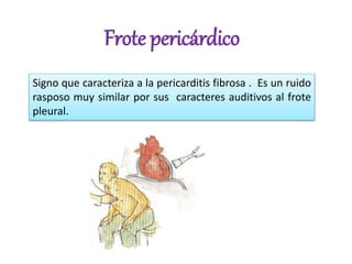 Frote pericárdico
Signo que caracteriza a la pericarditis fibrosa . Es un ruido
rasposo muy similar por sus caracteres auditivos al frote
pleural.
 