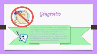 La Gingivitis es una enfermedad bucal generalmente
causada por bacterias y que produce una inflamación
de las encías y el sangrado de estas. Para evitar
padecer esta molesta enfermedad lo que tenemos
que evitar la acumulación de sarro mediante un buen
cepillado diario de los dientes y la lengua, junto con
el uso de enjuagues bucales y hilo dental
 