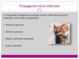 Propagación de la infección
La tiña puede contagiarse de muchas formas, tanto directas como
indirectas, entre ellas, las siguientes:
 Persona a persona
 Animal a persona
 Objeto inanimado a persona
 Suelo a persona
 
