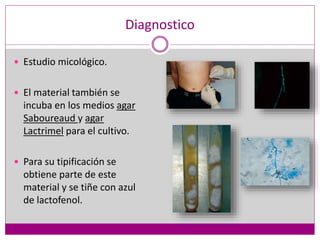 Diagnostico
 Estudio micológico.
 El material también se
incuba en los medios agar
Saboureaud y agar
Lactrimel para el cultivo.
 Para su tipificación se
obtiene parte de este
material y se tiñe con azul
de lactofenol.
 