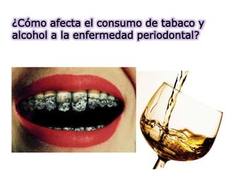 ¿Cómo afecta el consumo de tabaco y
alcohol a la enfermedad periodontal?
 