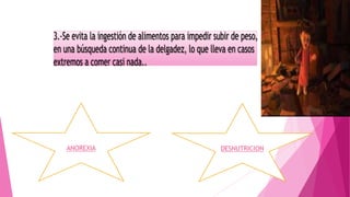 ANOREXIA DESNUTRICION
 