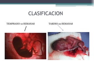CLASIFICACION
TEMPRANO 12 SEMANAS
/
TARDIO 22 SEMANAS
 