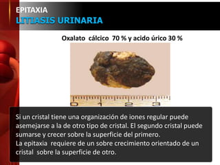 Si un cristal tiene una organización de iones regular puede
asemejarse a la de otro tipo de cristal. El segundo cristal puede
sumarse y crecer sobre la superficie del primero.
La epitaxia requiere de un sobre crecimiento orientado de un
cristal sobre la superficie de otro.
EPITAXIA
LITIASIS URINARIA
Oxalato cálcico 70 % y acido úrico 30 %
 