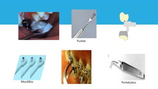 Mordillos Portatubos
Pusher
 
