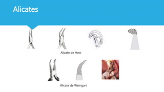 Alicate de How
Alicate de Weingart
Alicates
 