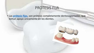 PROTESIS FIJA
• Las prótesis fijas, son prótesis completamente dentosoportadas, que
toman apoyo únicamente en los dientes.
 