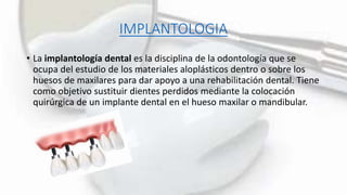 IMPLANTOLOGIA
• La implantología dental es la disciplina de la odontología que se
ocupa del estudio de los materiales aloplásticos dentro o sobre los
huesos de maxilares para dar apoyo a una rehabilitación dental. Tiene
como objetivo sustituir dientes perdidos mediante la colocación
quirúrgica de un implante dental en el hueso maxilar o mandibular.
 