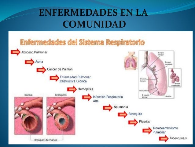 Como conocer hay unos parásitos en la persona