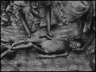 DESNUTRICION EN AFRICA