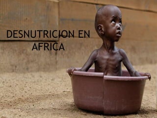 DESNUTRICION EN
AFRICA
 