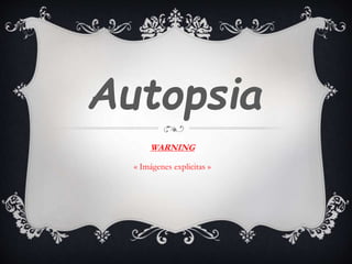Autopsia
« Imágenes explicitas »
WARNING
 