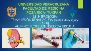 E.E. NEFROLOGÍA
TEMA: LESIÓN RENAL AGUDA [acute kidney injury
(AKI)]
ALUMNO: FLOR ELIDE FIGUEROA URRUTIA
UNIVERSIDAD VERACRUZANA
FACULTAD DE MEDICINA
POZA RICA- TUXPAN
 