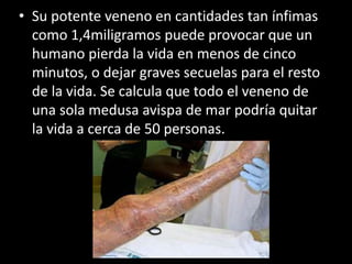 • Su potente veneno en cantidades tan ínfimas
como 1,4miligramos puede provocar que un
humano pierda la vida en menos de cinco
minutos, o dejar graves secuelas para el resto
de la vida. Se calcula que todo el veneno de
una sola medusa avispa de mar podría quitar
la vida a cerca de 50 personas.
 