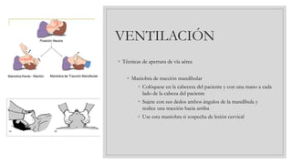 VENTILACIÓN
◦ Técnicas de apertura de vía aérea
◦ Maniobra de tracción mandibular
◦ Colóquese en la cabecera del paciente y con una mano a cada
lado de la cabeza del paciente
◦ Sujete con sus dedos ambos ángulos de la mandíbula y
realice una tracción hacia arriba
◦ Use esta maniobra si sospecha de lesión cervical
 